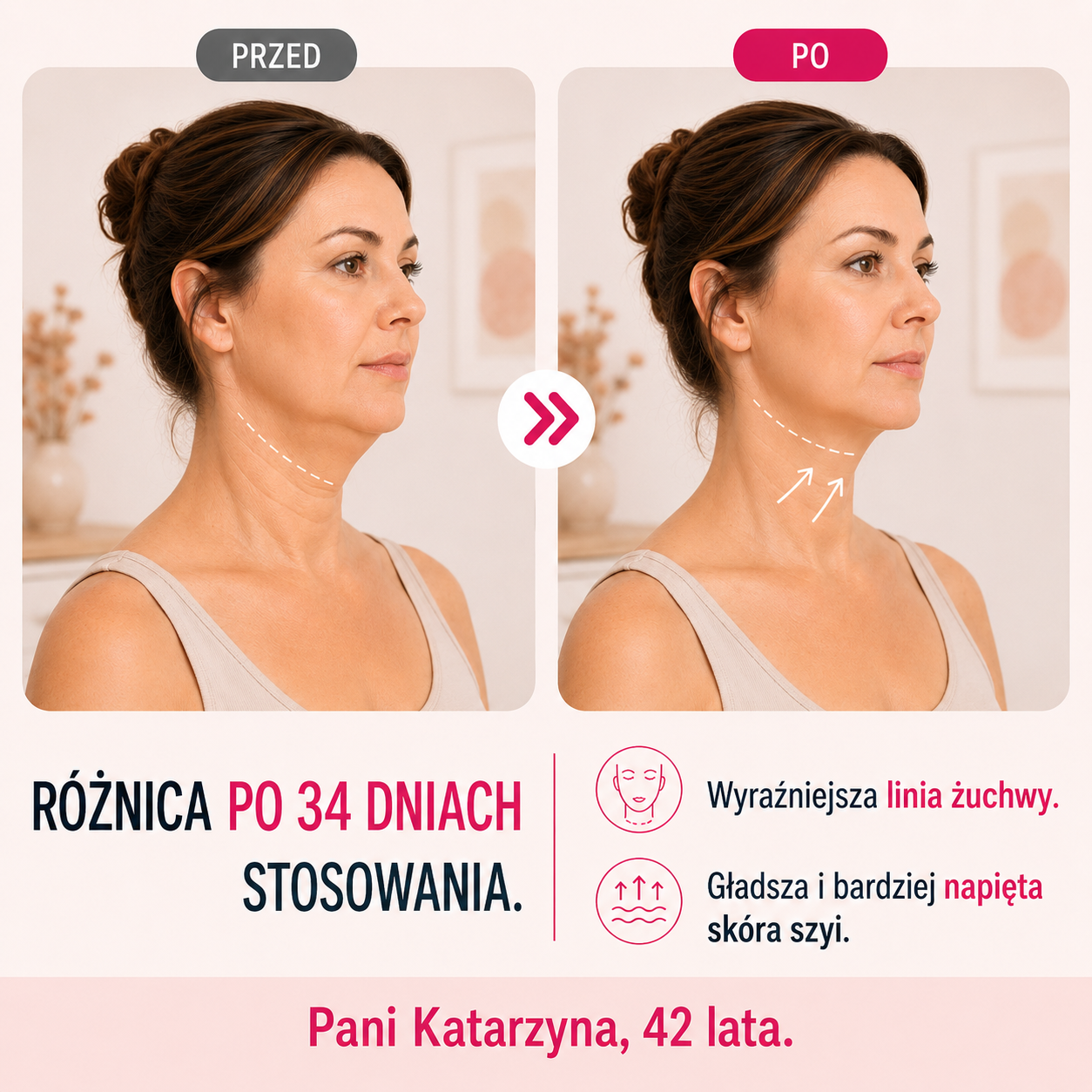 Efekty regularnego stosowania maski Linea